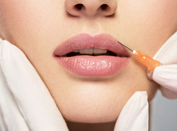 Dermal Fillers And Lip Injections In Melbourne