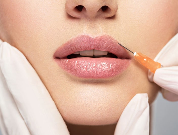 Dermal Fillers And Lip Injections In Melbourne
